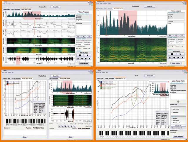 新一代DiVAS嗓音评估软件2.png