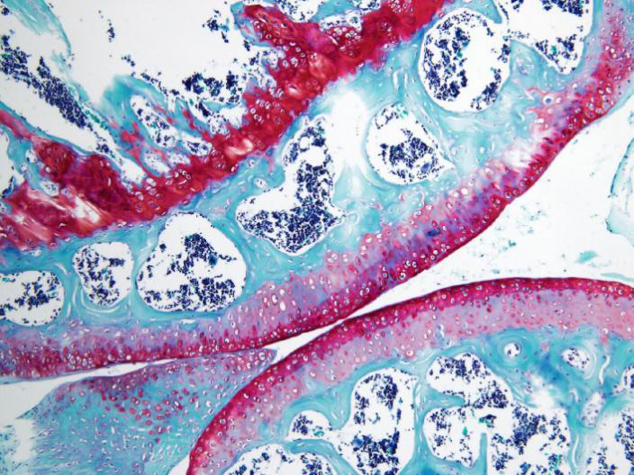 细胞核被he 染色染成鲜明的蓝色,软骨基质,钙盐颗粒呈深蓝色,粘液呈灰