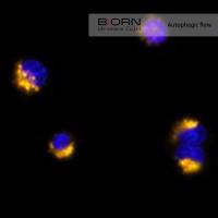 自噬研究综合解决方案