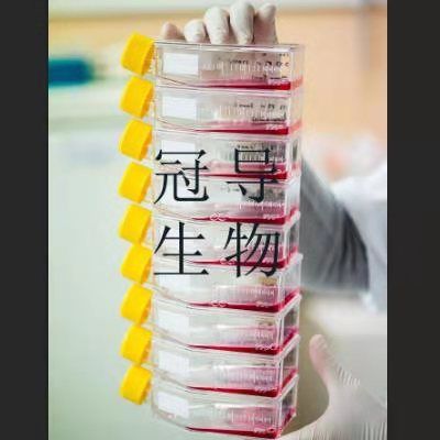 AHH1 Cells;人外周血B淋巴扩增细胞|STR鉴定图谱