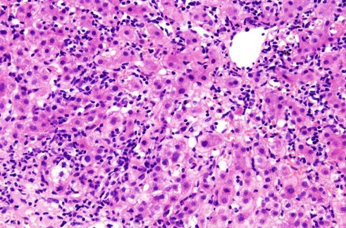 HE染色的注意事项