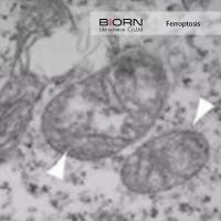 细胞死亡方式研究综合解决方案