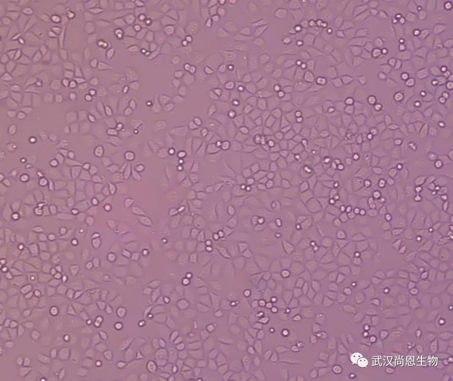 如何冻存细胞，简单操作流程及注意事项