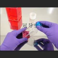 REC1 Cells;人淋巴瘤扩增细胞|STR鉴定图谱