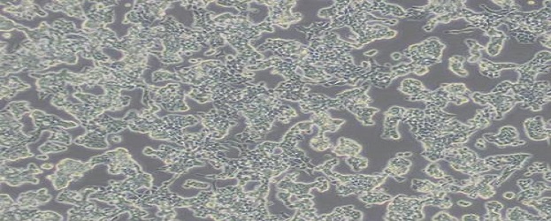 MDA-MB-231-GFP人乳腺癌细胞-绿色标记(附STR