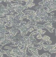 人结肠癌细胞-绿色标记