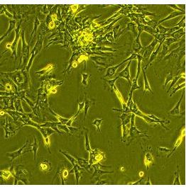 大鼠海綿體平滑肌細胞