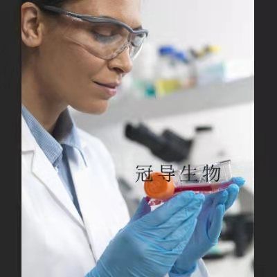 IPLB-SF-21 Cells;昆虫卵巢扩增细胞|STR鉴定图谱