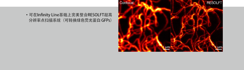 Infinity Line-STED超高分辨率显微镜