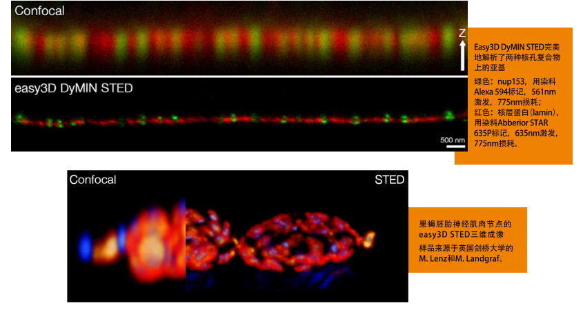 Infinity Line-STED超高分辨率显微镜