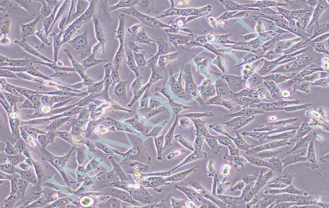 逸漠SF188人胶质母细胞瘤细胞