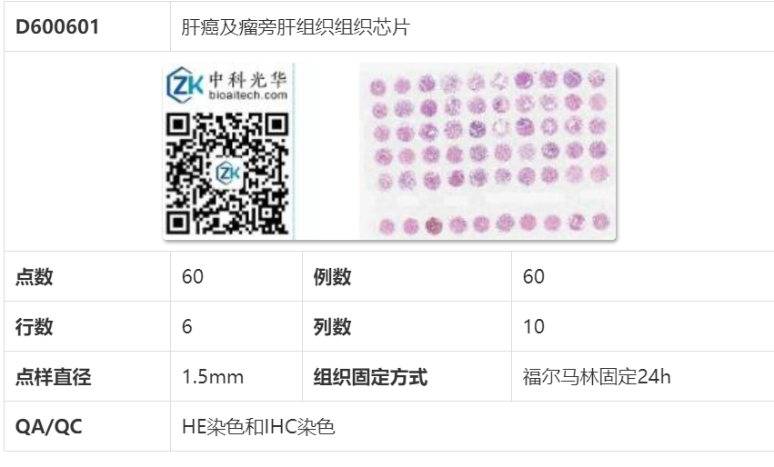 肝癌的组织类型