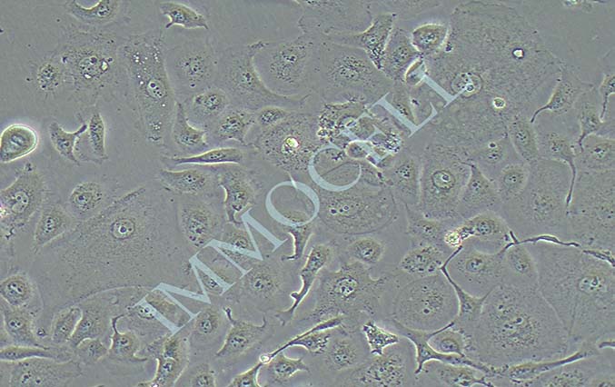 逸漠SUNE-1 低分化鼻咽癌细胞