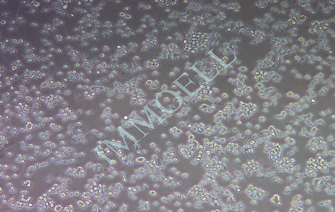 逸漠CA46人Burkitt’s淋巴瘤细胞