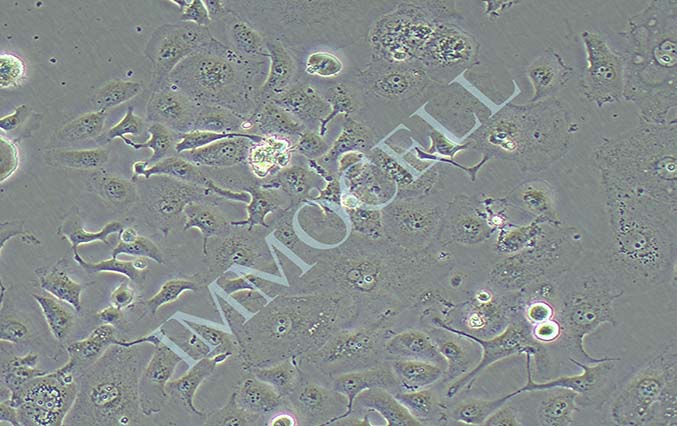 SUNE-1 低分化鼻咽癌细胞