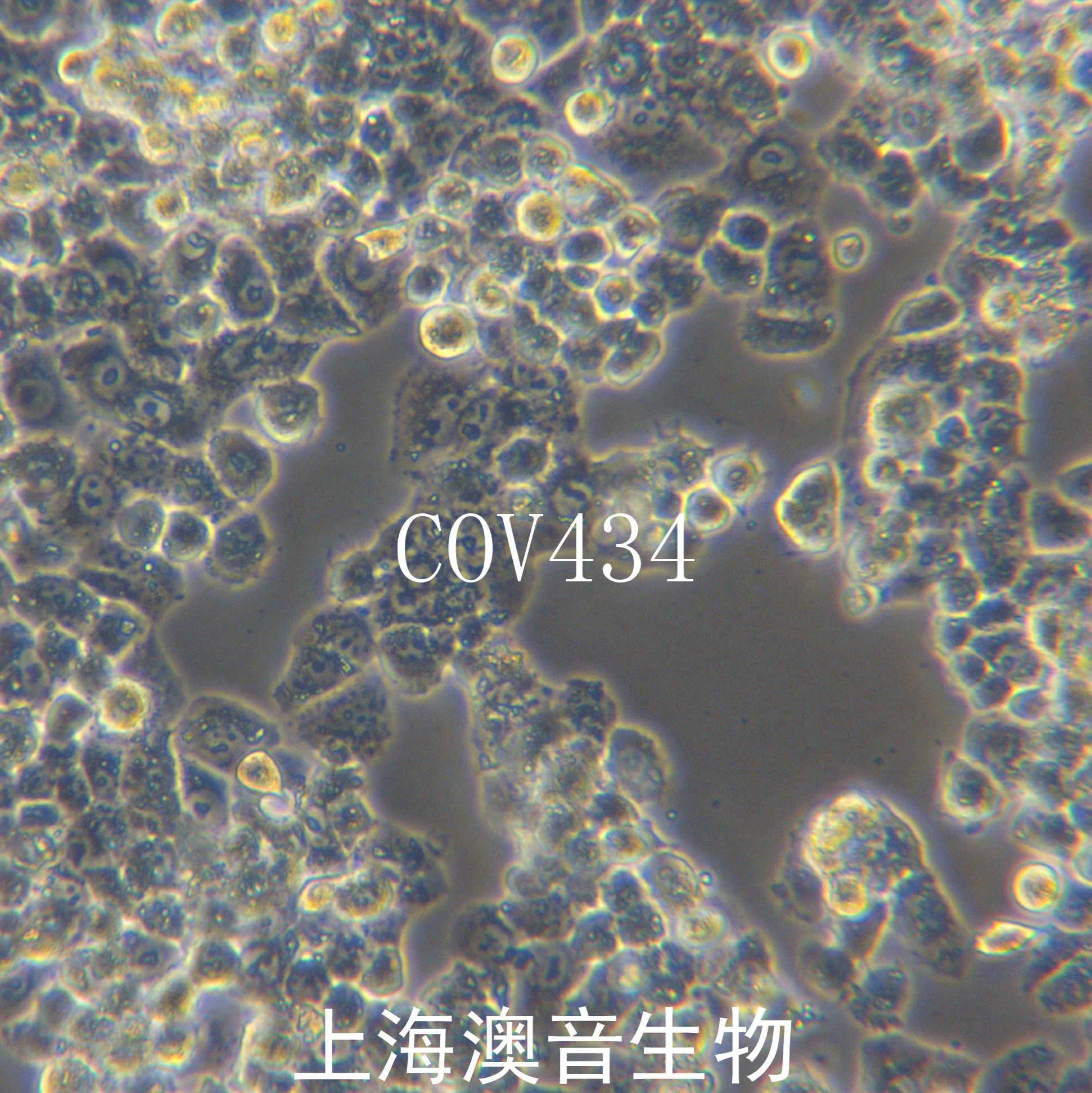 COV434[COV-434; COV 434]人卵巢颗粒肿瘤细胞