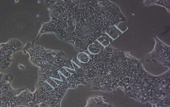 逸漠Capan-1 人胰腺癌细胞