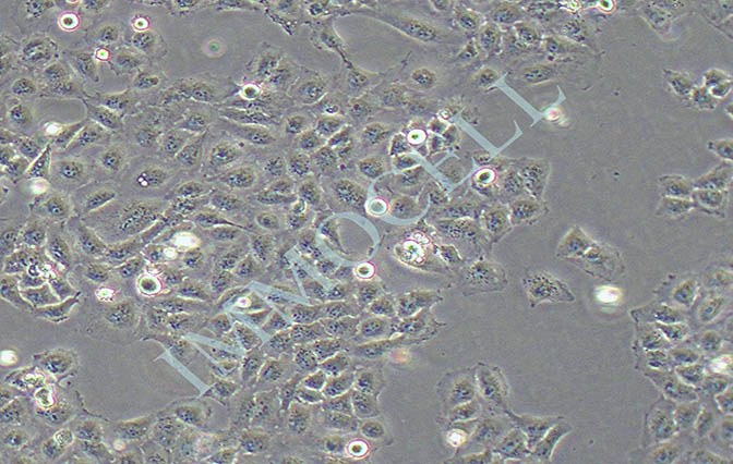 QGY-7701 人肝癌细胞