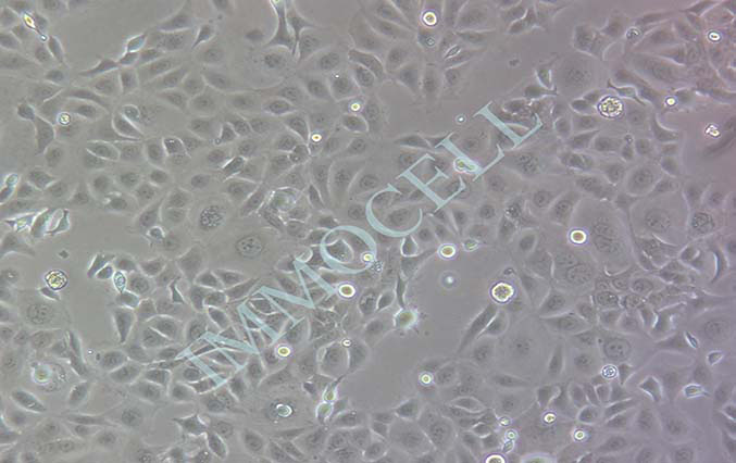 逸漠HPDE6-C7 人正常胰腺导管上皮细胞