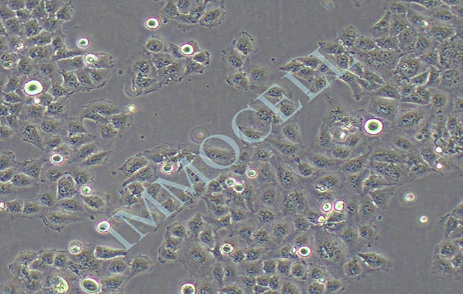 逸漠QGY-7701 人肝癌细胞