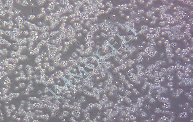 逸漠Kasumi-1 人急性髓母白血病细胞