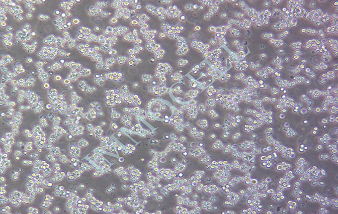 Kasumi-1 人急性髓母白血病细胞