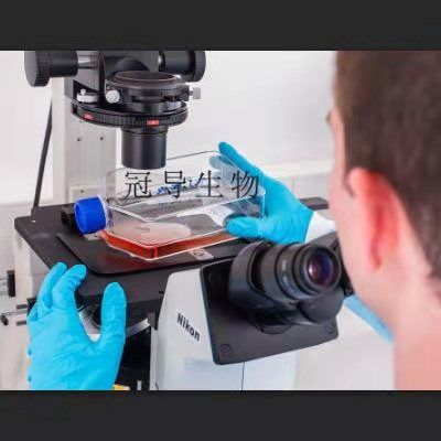 Cattle chondrocytes Cells;牛软骨克隆细胞|STR鉴定图谱