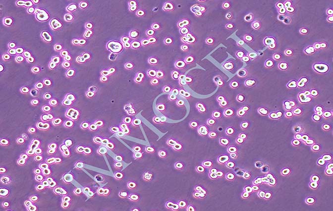 逸漠KATO III 人胃癌细胞