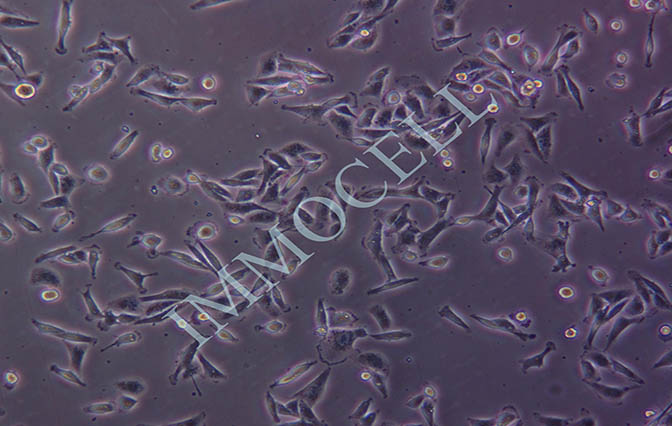 MDA-MB-231人乳腺癌细胞