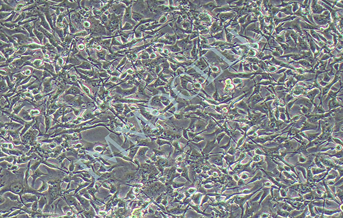 逸漠B16-F10小鼠黑色素瘤细胞