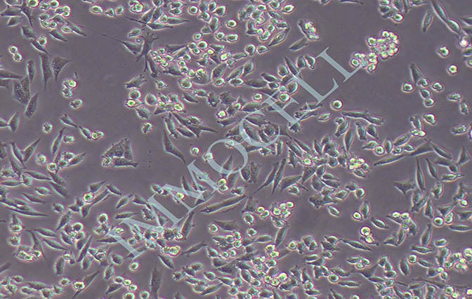 4T1小鼠乳腺癌细胞