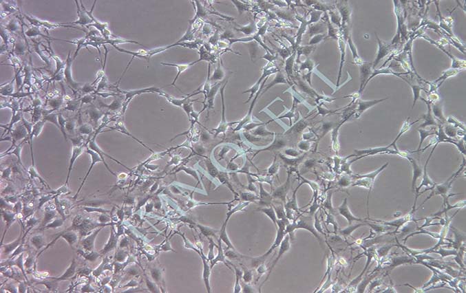 3T3-L1小鼠胚胎成纤维细胞