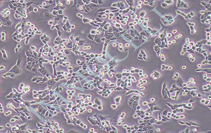 LLC小鼠Lewis肺癌细胞