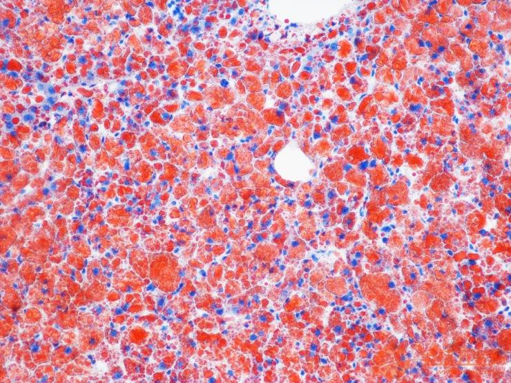 动物组织与细胞涂片的油红O染色技术