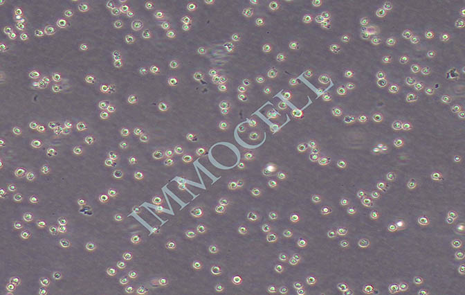 H22小鼠肝癌细胞