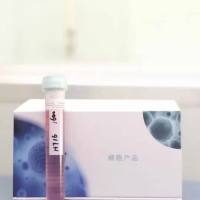 U251MG人类星型胶质细胞瘤(通过STR鉴定)