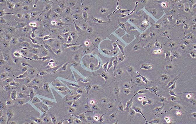 MDCK狗肾转化细胞