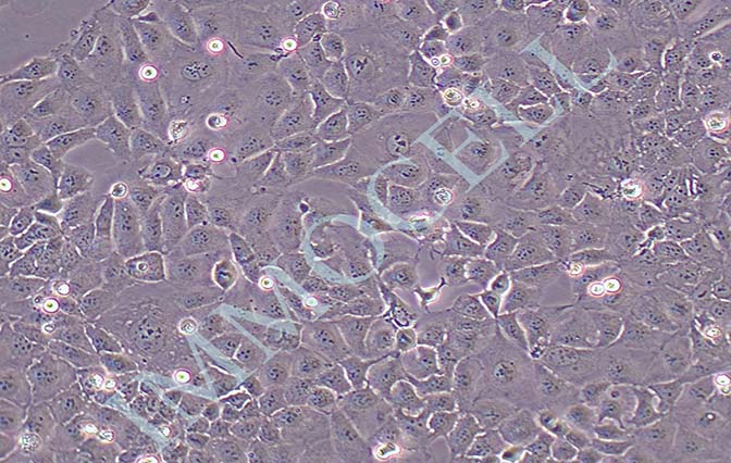 Caco-2人结肠癌细胞