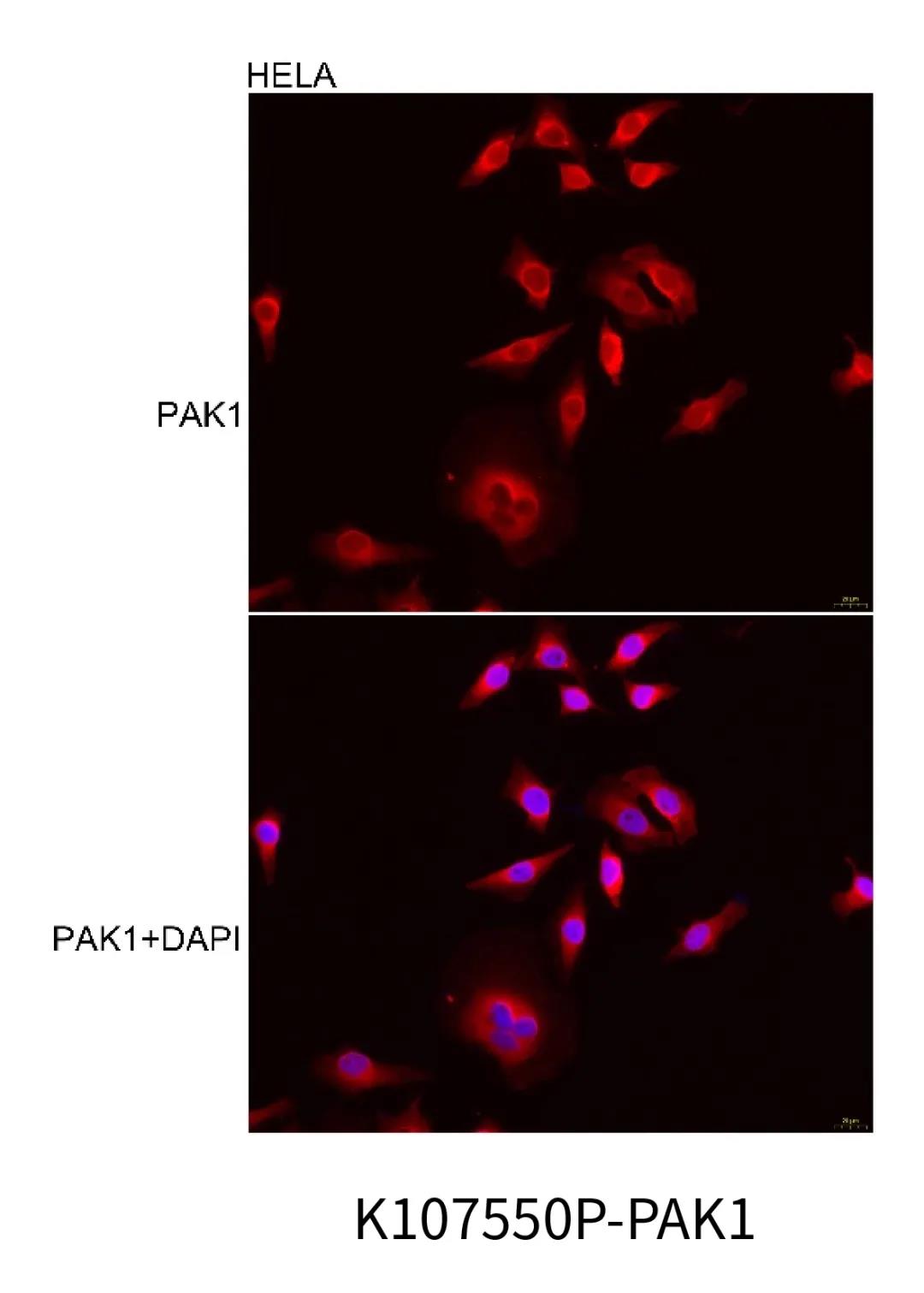 想做免疫荧光不会细胞爬片怎么行?