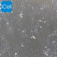 HCCC-9810细胞、HCCC-9810细胞、HCCC9810细胞、HCCC9810、人胆管细胞型肝癌细胞/STR鉴定/镜像绮点（Cellverse）