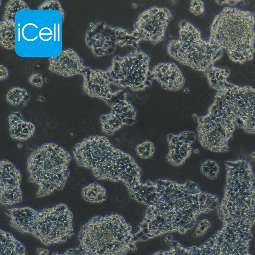 BETA-TC-6、BETA-TC-6细胞、BETATC6细胞、BETATC6、小鼠胰腺癌beta细胞  镜像绮点（Cellverse）