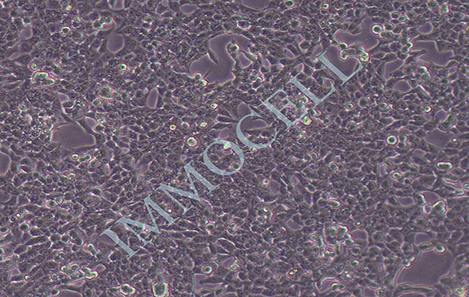 HCT-116人结肠癌细胞