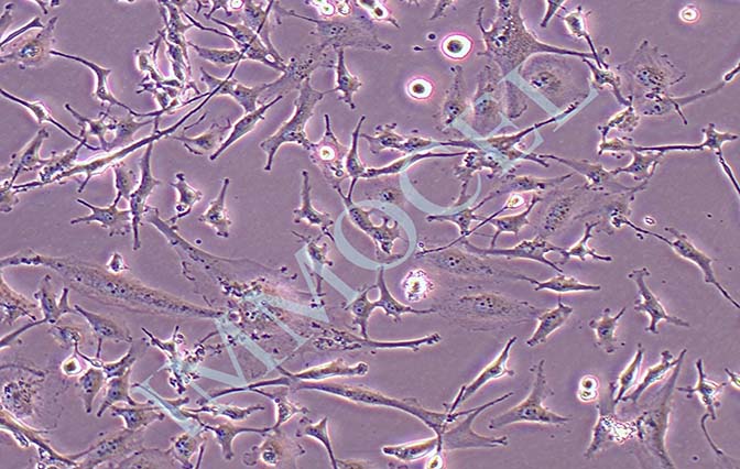 U251 MG/TMZ人类星形胶质瘤耐替莫唑胺耐药株细胞丨u