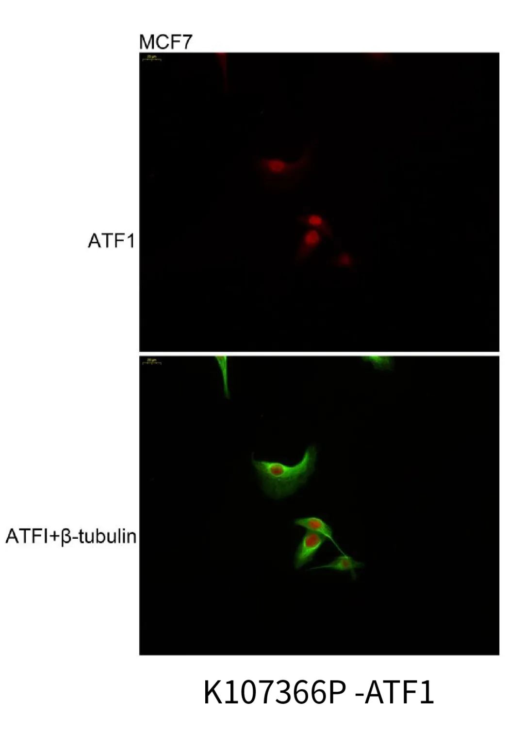 想做免疫荧光不会细胞爬片怎么行?