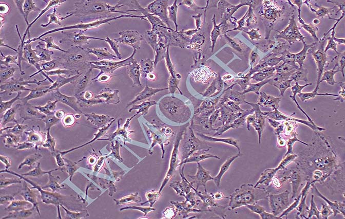U251 MG/TMZ人类星形胶质瘤耐替莫唑胺耐药株细胞丨u