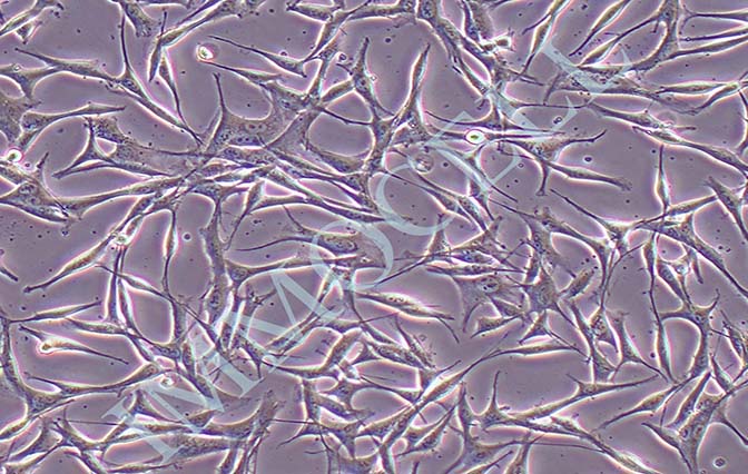 逸漠WM-115人恶性黑色素瘤细胞