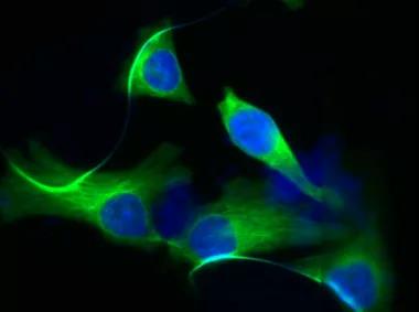 想做免疫荧光不会细胞爬片怎么行?