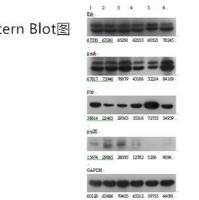 蛋白WB（Western Blot）检测服务