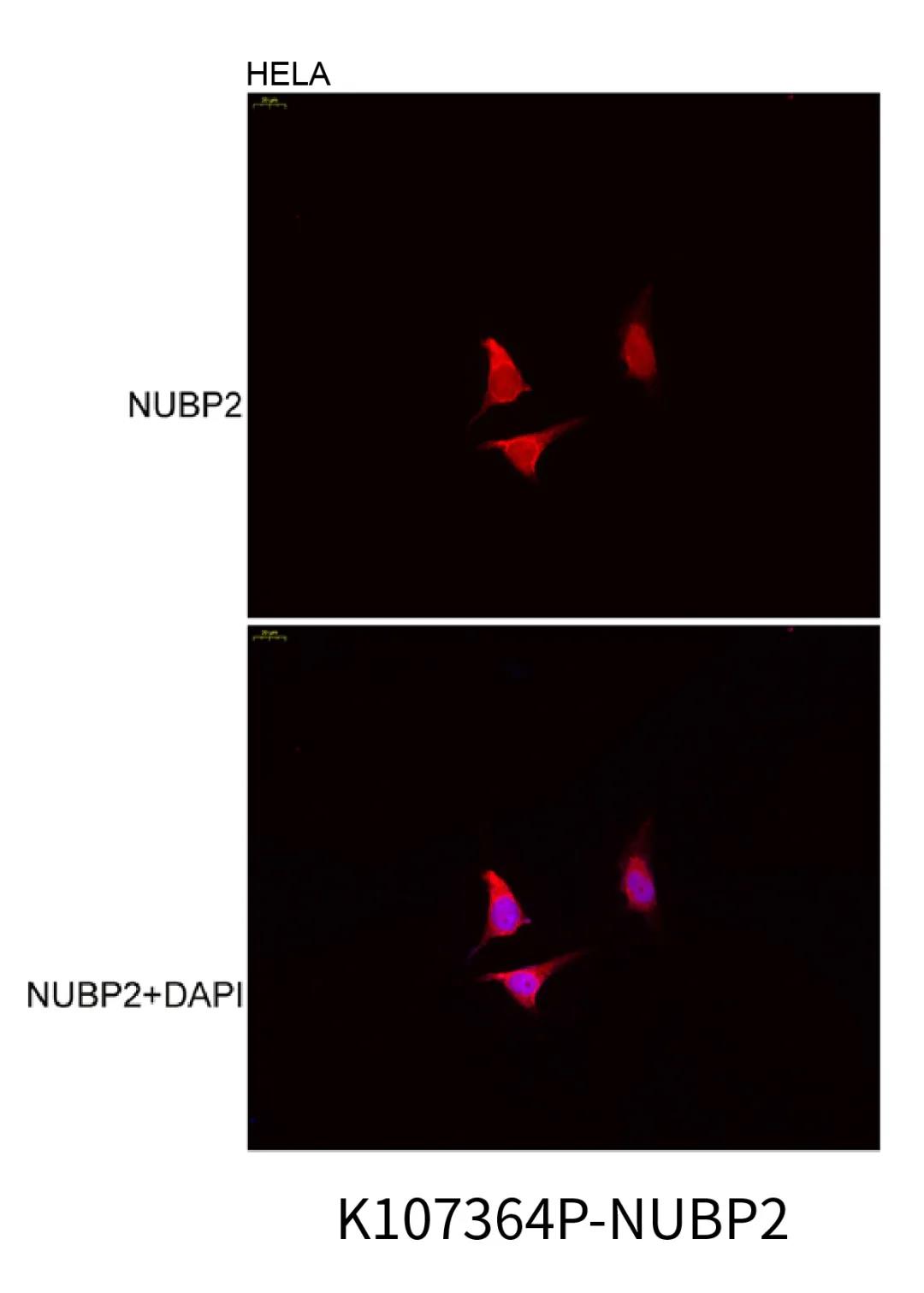 想做免疫荧光不会细胞爬片怎么行?