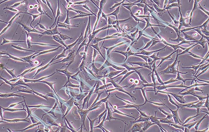 WM-115人恶性黑色素瘤细胞丨wm-115细胞系 价格丨S
